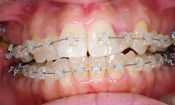 目立たない装置